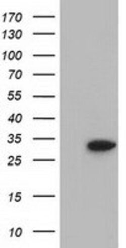 SULT2A1 Mouse anti-Human, Clone: OTI4D7, lyophilized, TrueMAB 100 &mu;g;