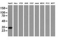 SULT2A1 Mouse anti-Human, Clone: OTI4D7, lyophilized, TrueMAB 100 &mu;g;