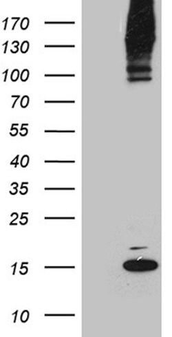SUMO1 Monoclonal Antibody (OTI1E8), TrueMAB , OriGene:Antibodies:Primary