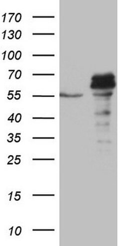 SUOX Monoclonal Antibody (OTI5A2), TrueMAB , OriGene 100 &mu;L; Unconjugated:Antibodies,