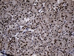 SUPT16H Monoclonal Antibody (OTI3B8), TrueMAB , OriGene:Antibodies:Primary