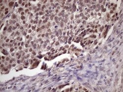 SUPT3H Monoclonal Antibody (OTI3D1), TrueMAB , OriGene:Antibodies:Primary