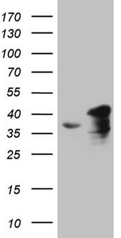 SUPT3H Monoclonal Antibody (OTI3D1), TrueMAB , OriGene:Antibodies:Primary