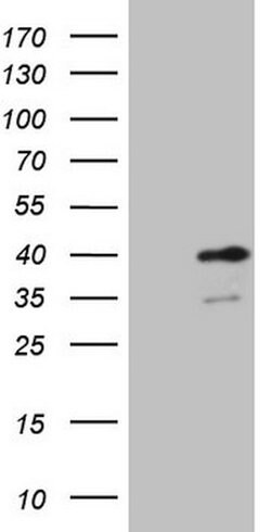 SUPT3H Mouse anti-Human, Clone: OTI4A6, lyophilized, TrueMAB 100 &mu;g;