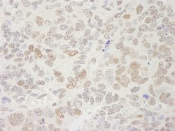 SUPT5H Polyclonal Antibody, Bethyl Laboratories:Antibodies:Primary Antibodies