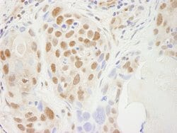 SUPT5H Polyclonal Antibody, Bethyl Laboratories 100 &mu;L; Unconjugated:Antibodies,