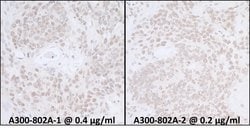 SUPT6H Rabbit anti-Human, Mouse, Polyclonal, Bethyl Laboratories 100 &mu;l;