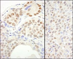 SUPT6H Rabbit anti-Human, Mouse, Polyclonal, Bethyl Laboratories 100 &mu;l;