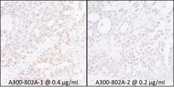 SUPT6H Rabbit anti-Human, Mouse, Polyclonal, Bethyl Laboratories 100 &mu;l;