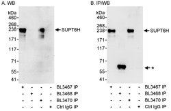SUPT6H Rabbit anti-Human, Polyclonal, Bethyl Laboratories 10 &mu;L; Unconjugated:Antibodies,