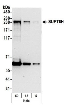 SUPT6H Rabbit anti-Human, Mouse, Polyclonal, Bethyl Laboratories 100 &mu;l;