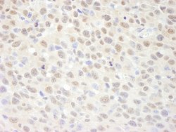 SUPT6H Polyclonal Antibody, Bethyl Laboratories 10 &mu;L | Buy Online | Bethyl Laboratories, Inc | Fisher Scientific