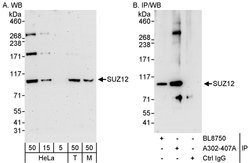 SUZ12 Rabbit anti-Human, Mouse, Polyclonal, Bethyl Laboratories 100 &mu;L;