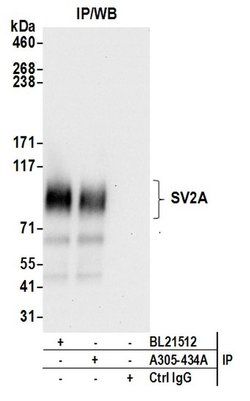 SV2A/SV2 Rabbit anti-Human, Polyclonal, Bethyl Laboratories 10 &mu;L; Unconjugated:Antibodies,