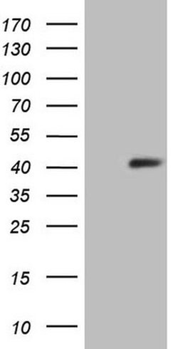 SYCP3 Monoclonal Antibody (OTI3H9), TrueMAB , OriGene 100 &mu;L | Buy Online | Origene Technologies | Fisher Scientific