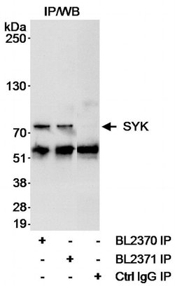 SYK Rabbit anti-Human, Polyclonal, Bethyl Laboratories 10 &mu;L; Unconjugated:Antibodies,