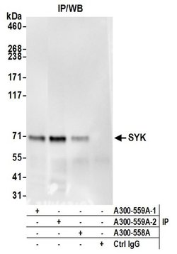 SYK Rabbit anti-Human, Polyclonal, Bethyl Laboratories 100 &mu;L; Unconjugated:Antibodies,