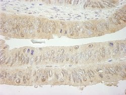 SYK Polyclonal Antibody, Bethyl Laboratories 10 &mu;L; Unconjugated:Antibodies,