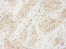 SYK Polyclonal Antibody, Bethyl Laboratories 10 &mu;L; Unconjugated:Antibodies,