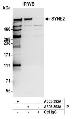 SYNE2/Nesprin 2 Rabbit anti-Human, Polyclonal, Bethyl Laboratories 10 &mu;L;