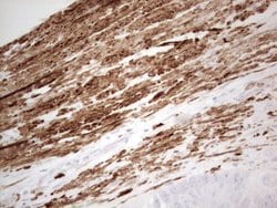 SYNM Monoclonal Antibody (OTI2F4), TrueMAB , OriGene 100 &mu;L; Unconjugated:Antibodies,