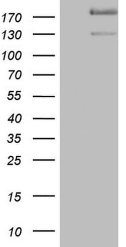 SYNM Mouse anti-Human, Clone: OTI7H6, TrueMAB , Origene 30 &mu;L; Unconjugated:Antibodies,