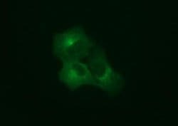 SYP Monoclonal Antibody (OTI1D4), TrueMAB , OriGene:Antibodies:Primary