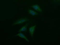 SYP Monoclonal Antibody (OTI2D8), TrueMAB , OriGene 100 &mu;L; Unconjugated:Antibodies,