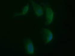 SYP Monoclonal Antibody (OTI5H2), TrueMAB , OriGene 100 &mu;L; Unconjugated:Antibodies,
