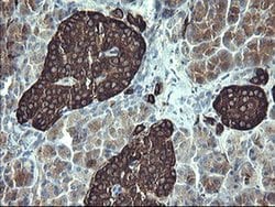 SYP Monoclonal Antibody (OTI2D8), TrueMAB , OriGene 100 &mu;L; Unconjugated:Antibodies,