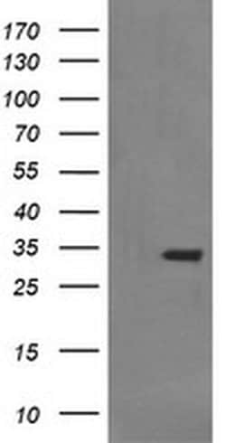 SYP Monoclonal Antibody (OTI1A1), TrueMAB , OriGene:Antibodies:Primary