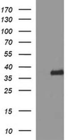 SYP Monoclonal Antibody (OTI3B12), TrueMAB , OriGene 100 &mu;L; Unconjugated:Antibodies,