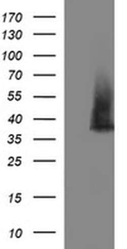 SYP Monoclonal Antibody (OTI2D8), TrueMAB , OriGene 100 &mu;L; Unconjugated:Antibodies,