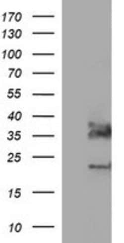 SYP Mouse anti-Human, Clone: OTI1C9, lyophilized, TrueMAB 100 &mu;g; Unconjugated:Antibodies,