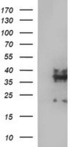 SYP Mouse anti-Canine, Human, Clone: OTI5H2, lyophilized, TrueMAB 100 &mu;g;