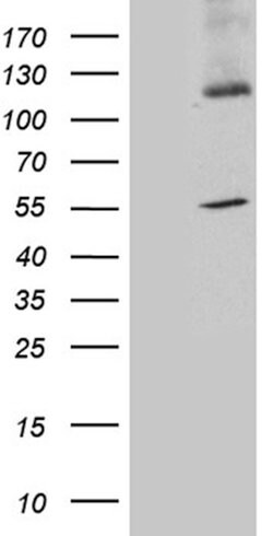 SYT11 Mouse anti-Human, Clone: OTI3F3, lyophilized, TrueMAB 100 &mu;g;
