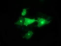 SYT4 Monoclonal Antibody (OTI2F2), TrueMAB , OriGene 100 &mu;L; Unconjugated:Antibodies,