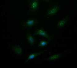 SYT4 Monoclonal Antibody (OTI2F2), TrueMAB , OriGene 100 &mu;L; Unconjugated:Antibodies,