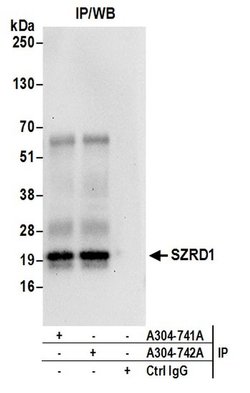 SZRD1 Rabbit anti-Human, Polyclonal, Bethyl Laboratories 100 &mu;L; Unconjugated:Antibodies,