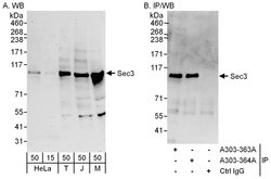 Sec3 Rabbit anti-Human, Mouse, Polyclonal, Bethyl Laboratories 100 &mu;L;