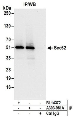 Sec62 Rabbit anti-Human, Mouse, Polyclonal, Bethyl Laboratories 100 &mu;L;