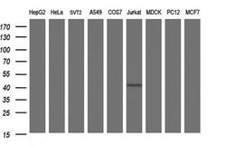 Septin 1 Monoclonal Antibody (OTI1E1), TrueMAB , OriGene:Antibodies:Primary