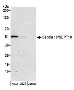 Septin 10/SEPT10 Polyclonal Antibody, Bethyl Laboratories 20 &mu;L; Unconjugated:Antibodies,