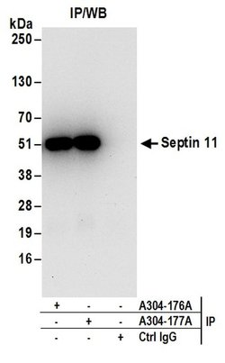 Septin 11 Rabbit anti-Human, Mouse, Polyclonal, Bethyl Laboratories 100