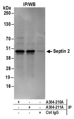 Septin 2 Rabbit anti-Human, Mouse, Polyclonal, Bethyl Laboratories 100