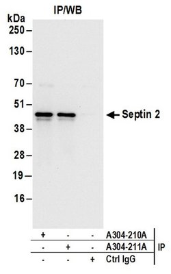 Septin 2 Rabbit anti-Human, Mouse, Polyclonal, Bethyl Laboratories 100