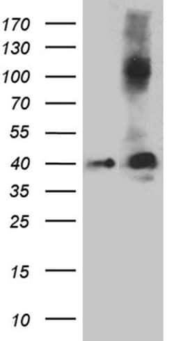 Septin 3 Monoclonal Antibody (OTI3H6), TrueMAB , OriGene 100 &mu;L; Unconjugated:Antibodies,