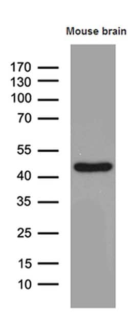 Septin 3 Monoclonal Antibody (OTI2G3), TrueMAB , OriGene 100 &mu;L; Unconjugated:Antibodies,