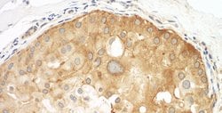 Septin 9 Rabbit anti-Human, Polyclonal, Bethyl Laboratories 100 &mu;L | Buy Online | Bethyl Laboratories, Inc | Fisher Scientific