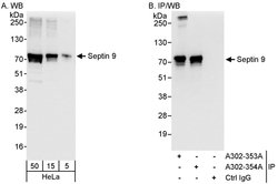 Septin 9 Rabbit anti-Human, Polyclonal, Bethyl Laboratories 100 &mu;L | Buy Online | Bethyl Laboratories, Inc | Fisher Scientific